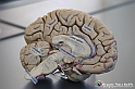 VBS_2989 - Cervello - Mostra Body Worlds